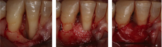 Caso1_Periodoncia