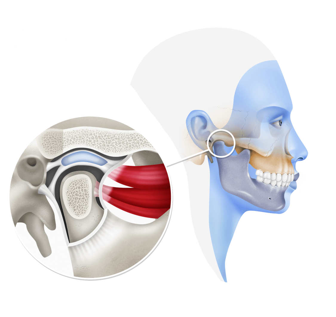 Acusación Entender servidor Articulación Temporomandibular - Cirugía Oral y Maxilofacial