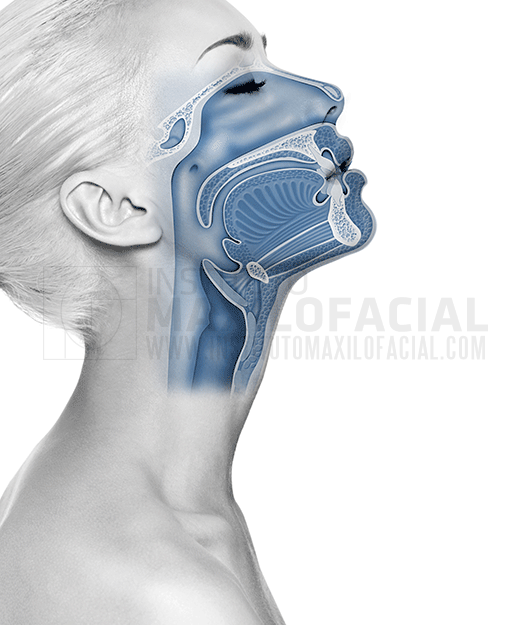 Férulas de Avance Mandibular » Apnea del Sueño - Instituto Maxilofacial