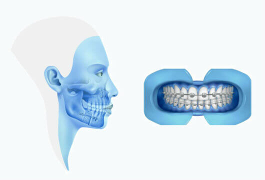 protocolo surgery first