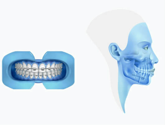 Protocolo surgery last