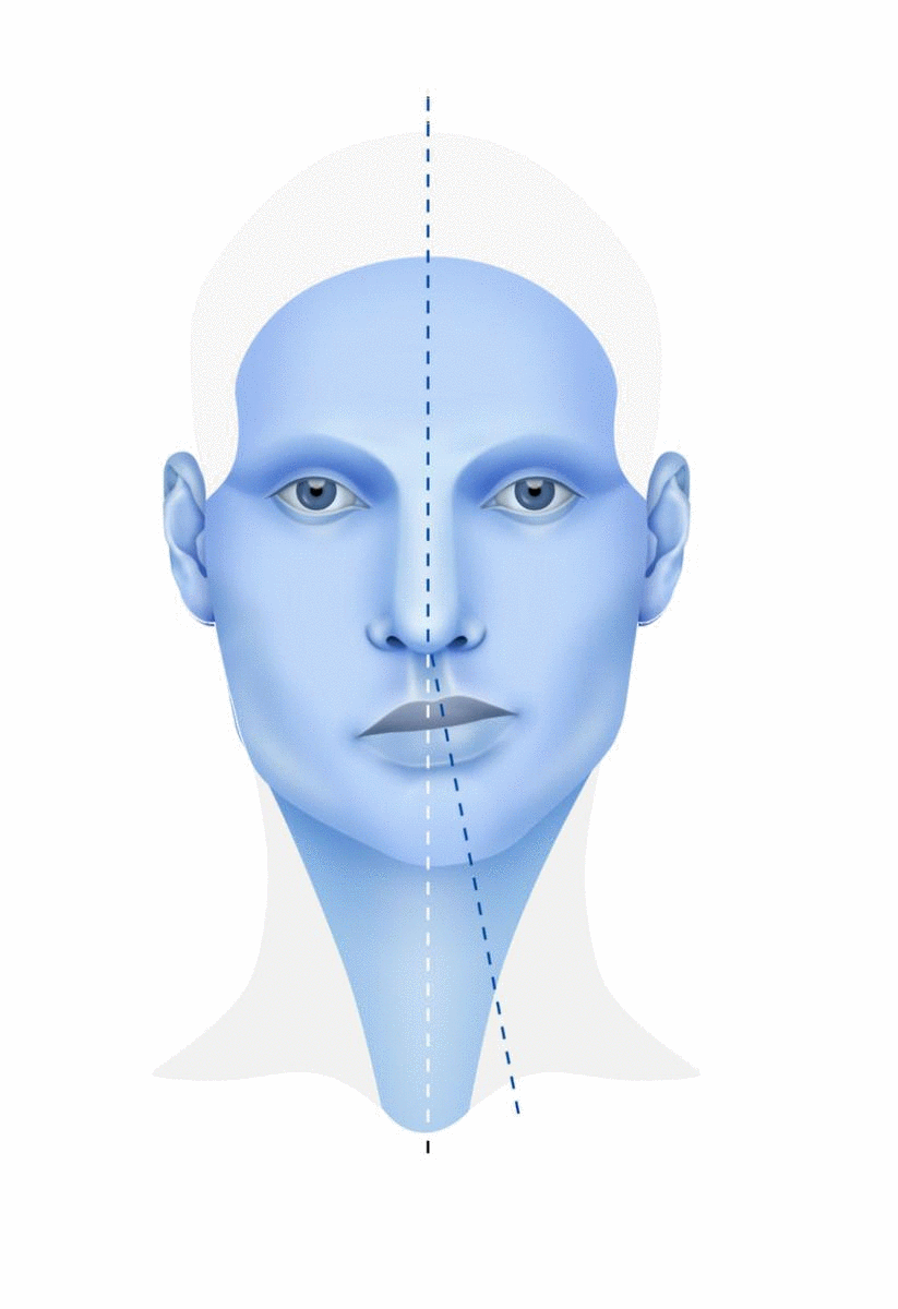 Asimetría Facial » Cirugía Ortognática - Instituto Maxilofacial