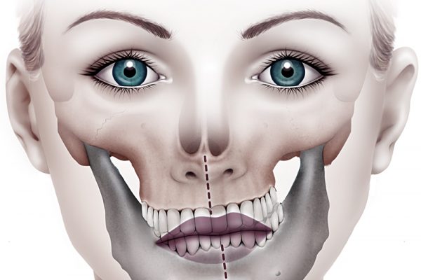 Cirugía Estética Facial - Instituto Maxilofacial