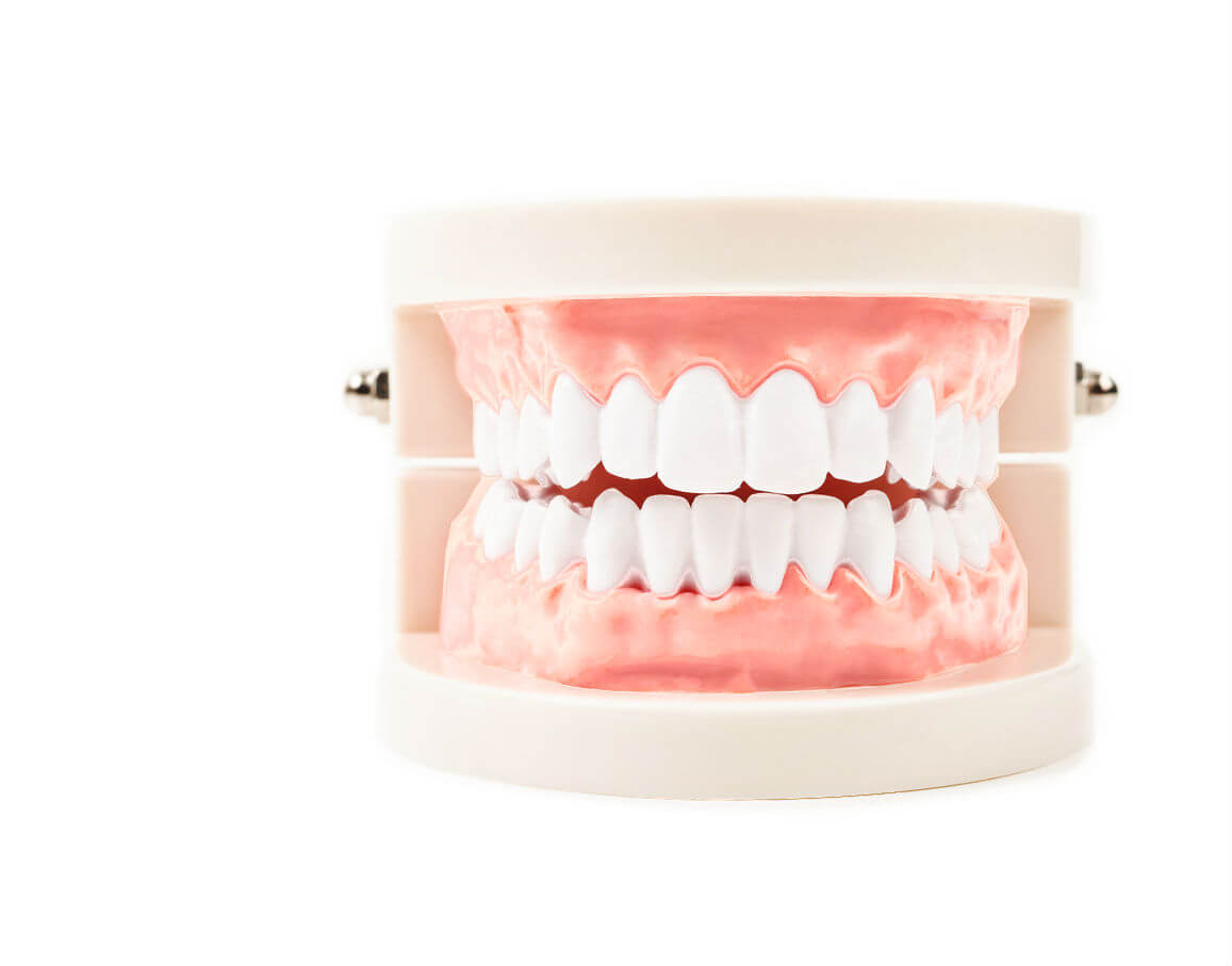 Dientes En Un D a Implantes Dentales Instituto Maxilofacial