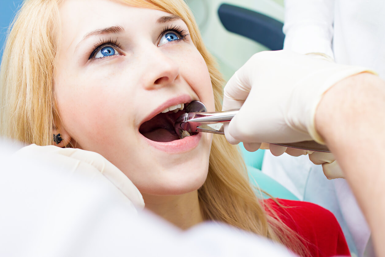 О зубной боли или показания к удалению зуба