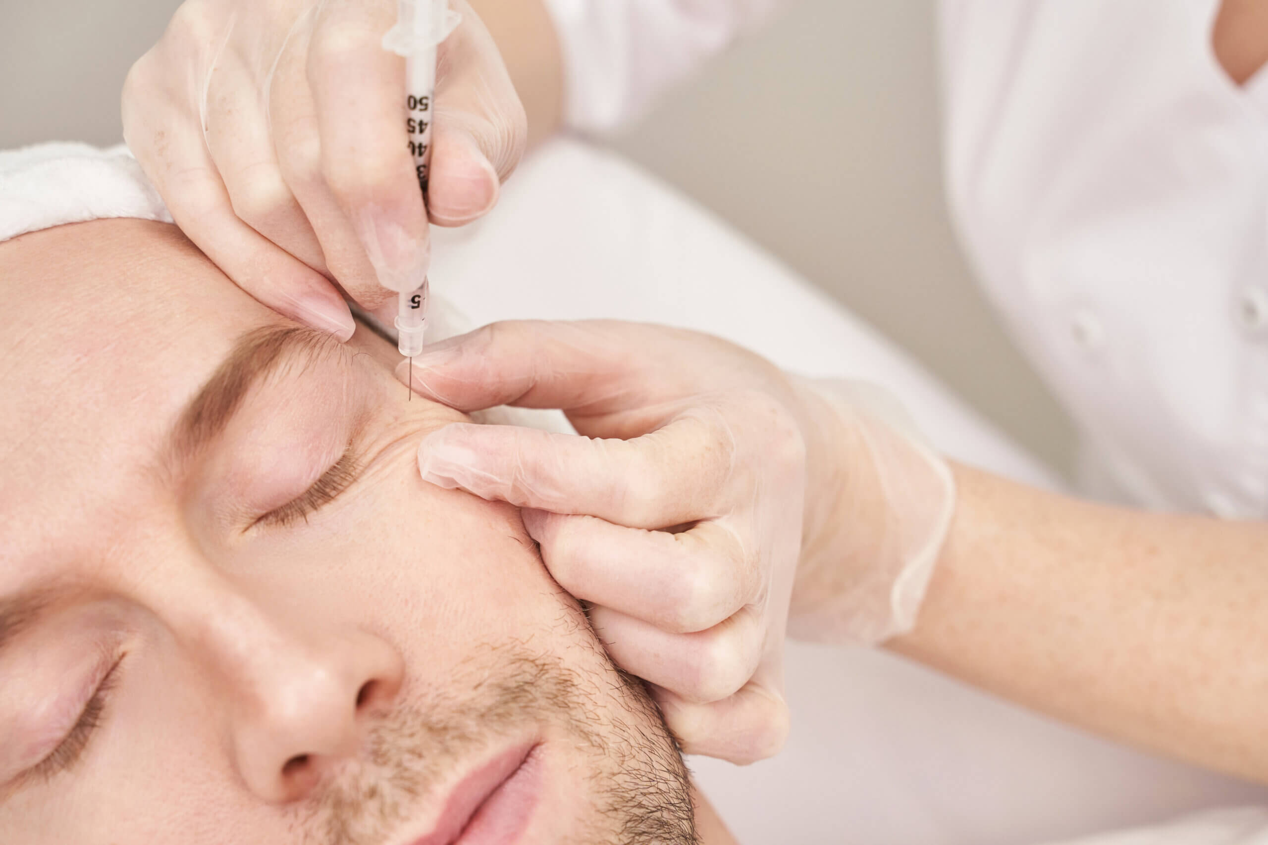 ¿Por qué hacerse mesoterapia facial?