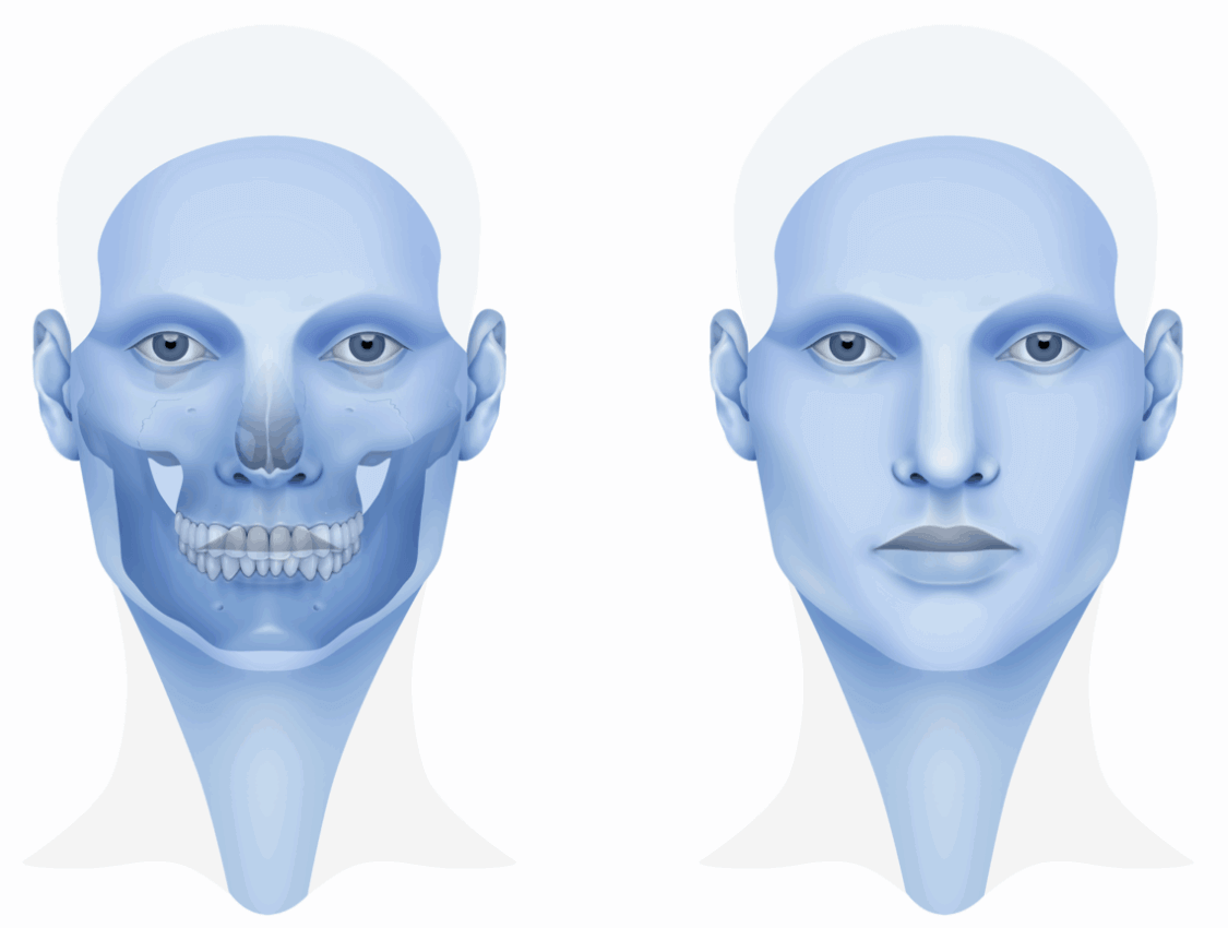 Orthognathic surgery